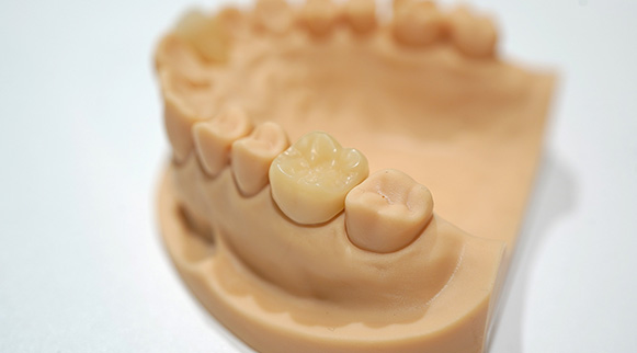 ハイブリッドセラミック