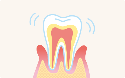 歯がぐらつくイメージ図