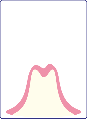 歯がない状態のイラスト