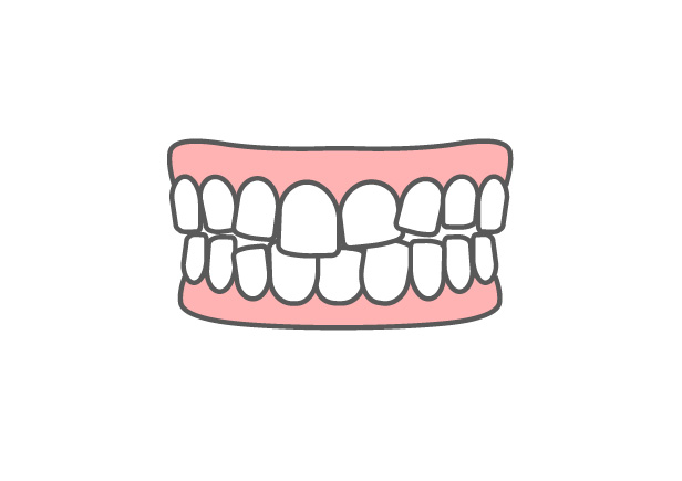 叢生（そうせい）